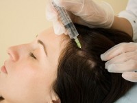 Озонотерапия волосистой части головы: показания к применению и описание процедуры