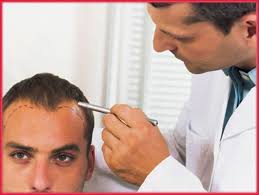 Этапы процедцры трансплантации волос