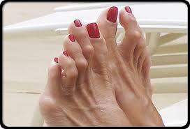 Деформация пальцев ног