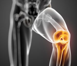 Риск возникновения артрита у мужчин и женщин зависит от разных причин