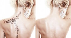 Способы удаления татуировок